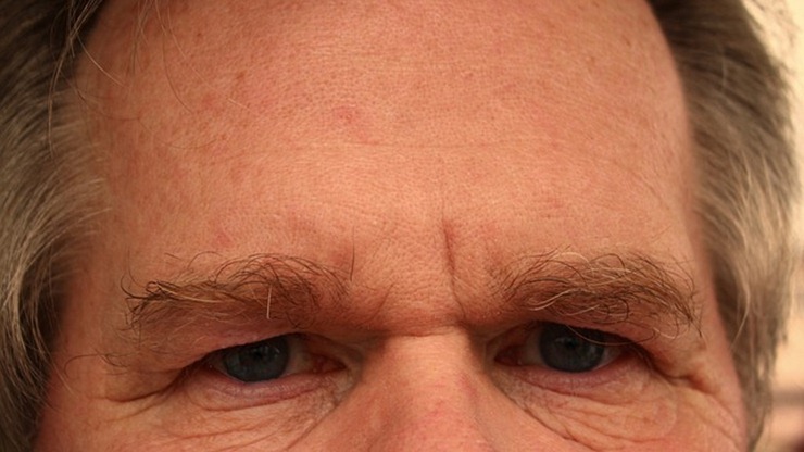 forehead-65059_640